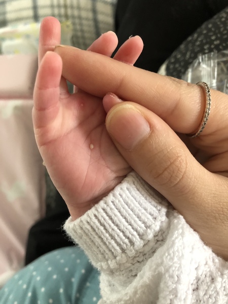 Spots on baby’s hand, what is it???
