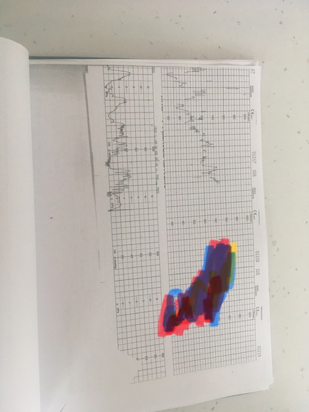 Can anyone with a medical background read these labour traces