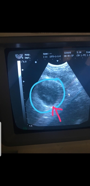 November 2020 Babies - thread 2