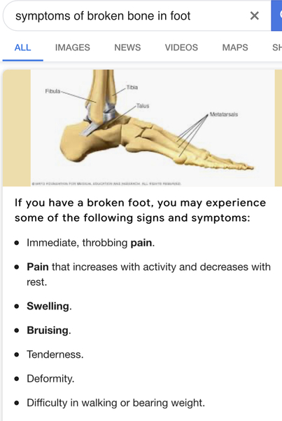 To refuse to take DS to hospital for a sprained ankle