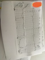 Can anyone with a medical background read these labour traces