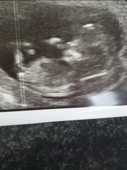 Just for fun - Boy or girl?