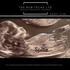 The nubtechs said 85% girl and......