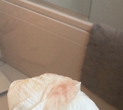 TMI photo- could it be plantation bleeding?