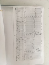 Can anyone with a medical background read these labour traces