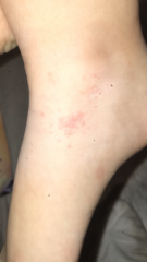 Anyone have family in dermatology ?