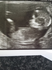 Just for fun - Boy or girl?