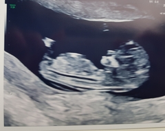 Just for fun....nub theory 12 weeks