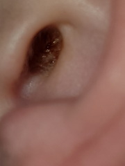 DH Ear wax....with pictures..
