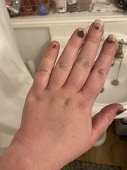 Do I need to go get checked out tonight or should I wait until Wednesday?