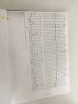 Can anyone with a medical background read these labour traces