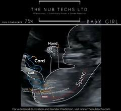 Girl or boy? Scan pic 10 and 12 weeks