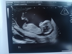 Pregnant after loss and dreaming of rainbows - 2