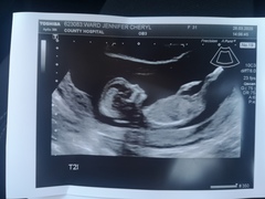 Pregnant after loss and dreaming of rainbows - 2