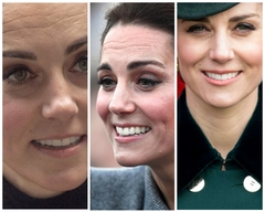 No wrinkles at 42?