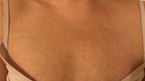 Can anyone advise me on my chest skin (with non-dodgy pics)