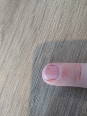 What's this under my nail