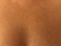 Can anyone advise me on my chest skin (with non-dodgy pics)