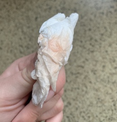Did I have a miscarriage or am I still pregnant ?