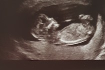 Early Oct babies part 3!