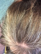 hair advice - grey