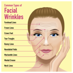 No wrinkles at 42?