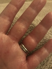 Anyone advise on stuck ring/swollen finger?