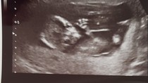 Early Oct babies part 3!
