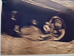 Just for fun....nub theory 12 weeks
