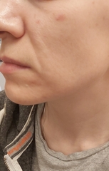 Help fix my face