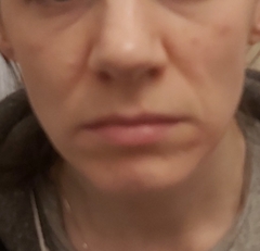 Help fix my face