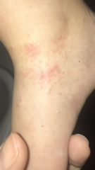 Anyone have family in dermatology ?
