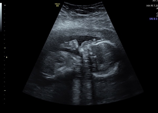 Pregnant after loss and dreaming of rainbows - 3