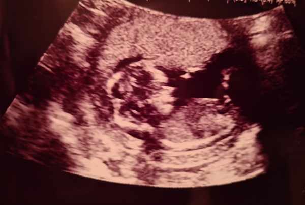 Scan guesses...