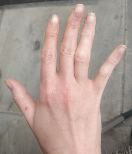 How old am I judging by my hands?