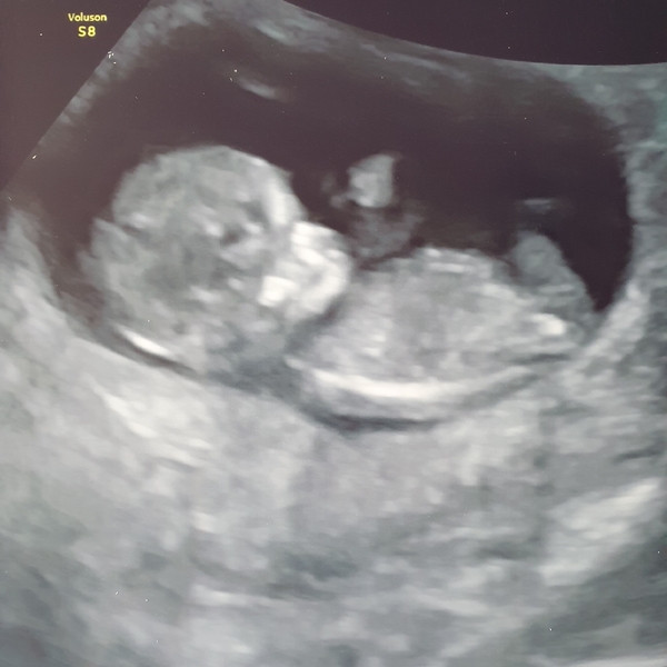 Late October babies - Thread 2