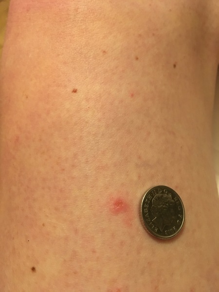 What’s this on my leg?