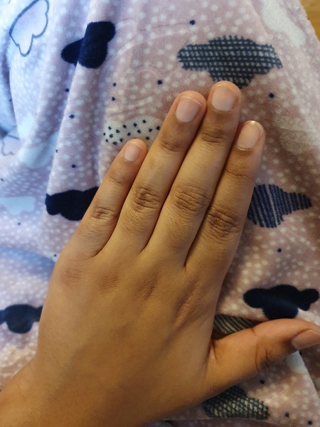 How old am I judging by my hands?