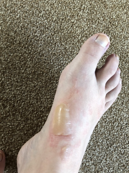 Advice wanted (gross) picture attached!