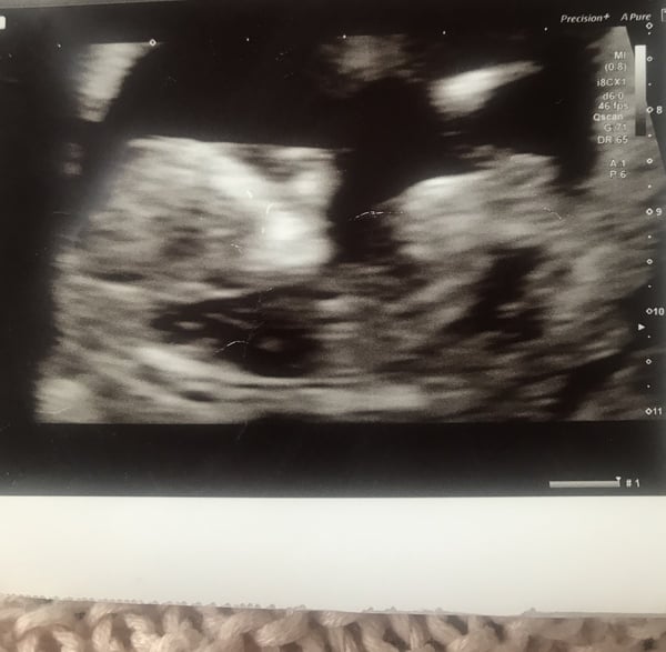 November 2020 Babies - Thread 5