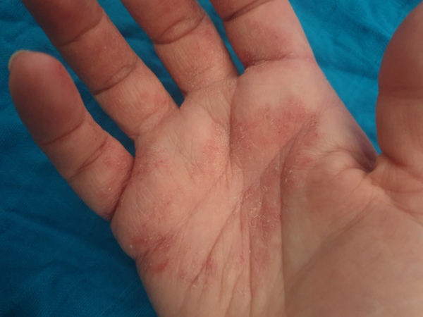Anyone got any ideas how I can sort my hands out?