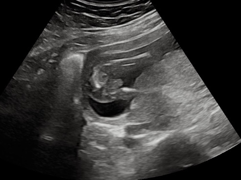 Definitely a boy?