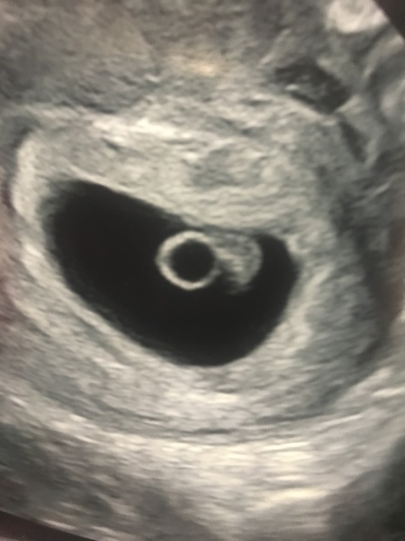 November 2020 Babies - Thread 4
