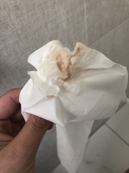 TMI photo! Is this implantation?