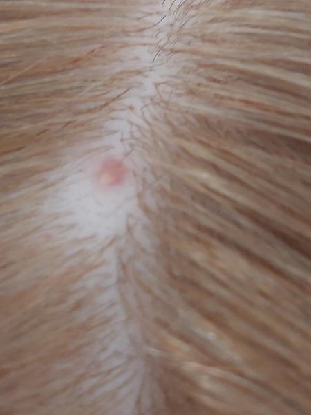 To be really worried about spot on DD's scalp?
