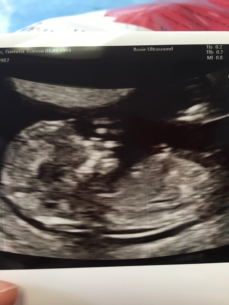 November 2020 Babies - Thread 5