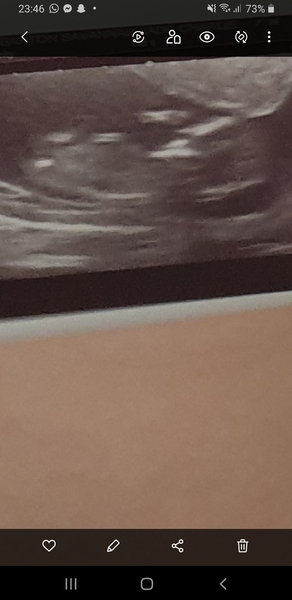 Nub guesses...submit your photos!