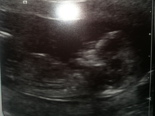 Nub theory