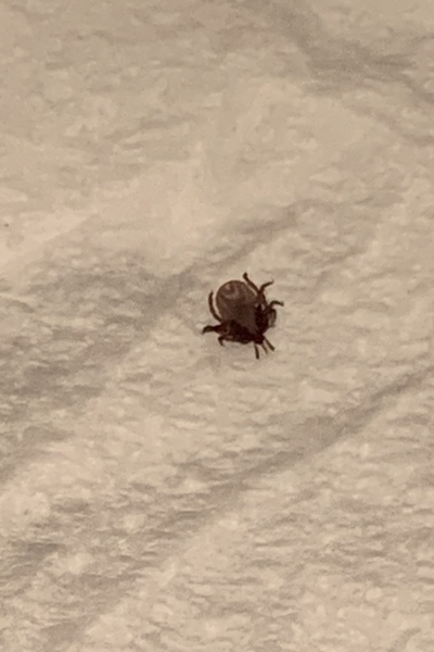 Freaking out here. Tick bite? Photo attached