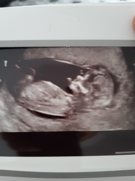 November 2020 Babies - Thread 5